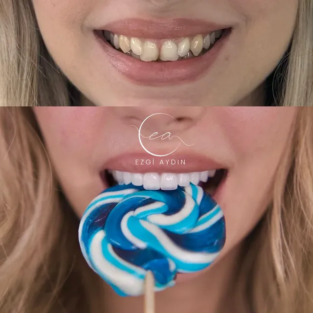 Patient Case 01 before and after