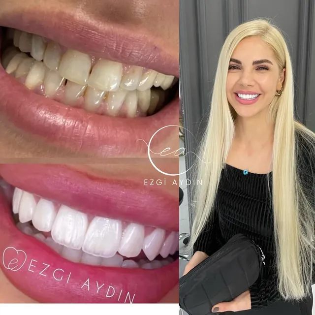 Patient Case 02 before and after
