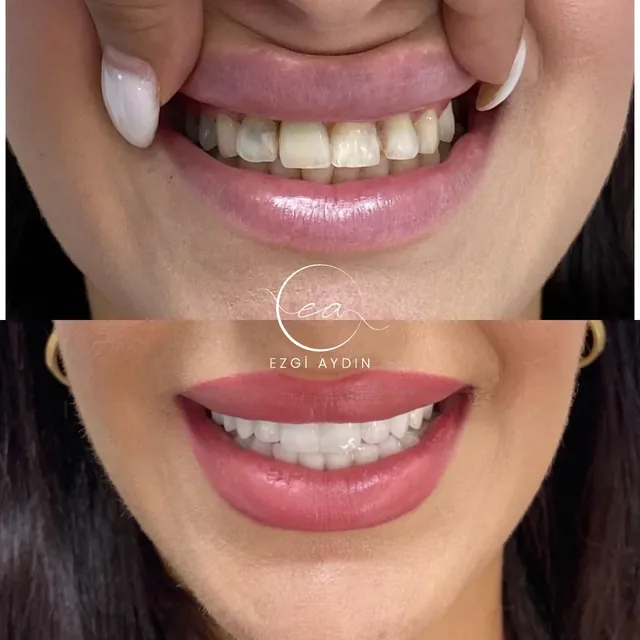 Patient Case 03 before and after