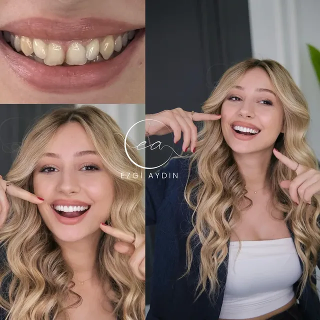 Patient Case 04 before and after